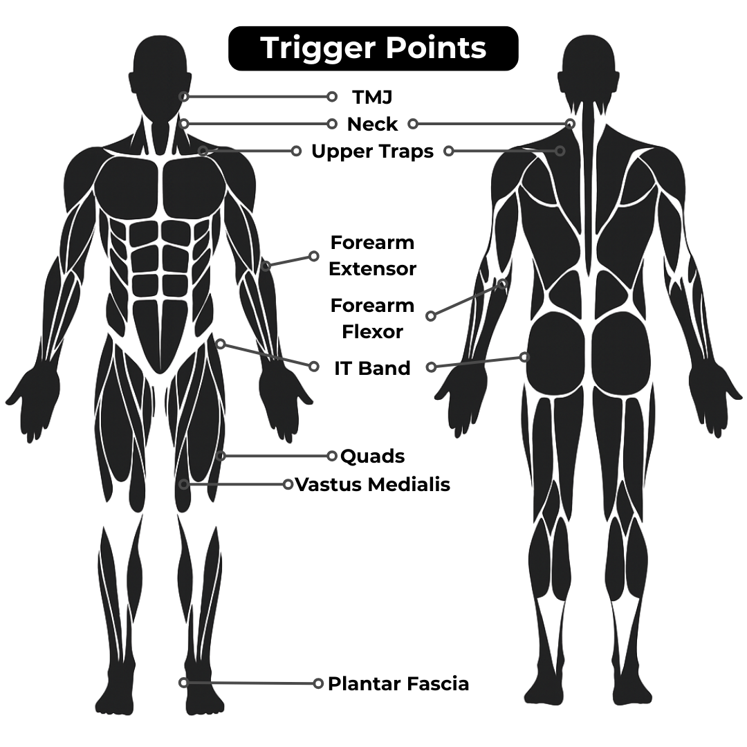The Intruder™ diagram shows front and back body views, highlighting common trigger points for tennis elbow therapy, including TMJ, neck, upper traps, forearm extensors/flexors, IT band, quads, vastus medialis, and plantar fascia.